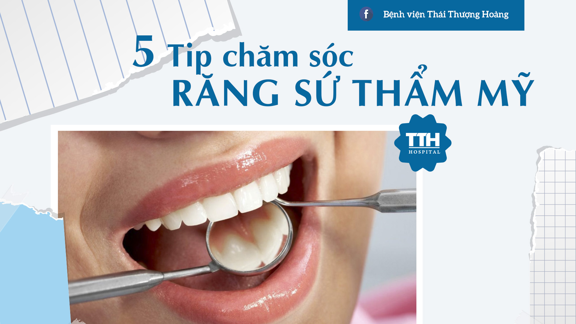 5 TIP GIÚP CHĂM SÓC RĂNG SỨ THẨM MỸ HIỆU QUẢ